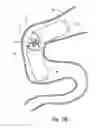 Fig. 03 - Device, system and method for in-vivo sensing of a body lumen