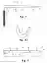 Fig. 04 - Methods for percutaneous spinal surgery