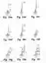 Fig. 07 - Methods for percutaneous spinal surgery