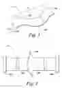 Fig. 02 - Non-rigid surgical retractor