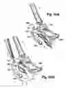 Fig. 32 - Surgical retractor platform blade apparatus