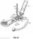 Fig. 33 - Surgical retractor platform blade apparatus