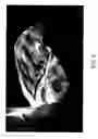 Fig. 03 - Method to image the heart