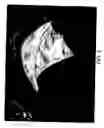 Fig. 04 - Method to image the heart