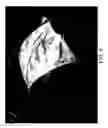 Fig. 05 - Method to image the heart