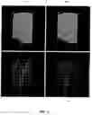 Fig. 06 - Medical device system and method for tracking and visualizing a medical device system under MR guidance