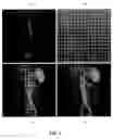 Fig. 08 - Medical device system and method for tracking and visualizing a medical device system under MR guidance