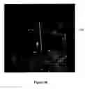 Fig. 35 - Medical device system and method for tracking and visualizing a medical device system under MR guidance