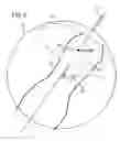 Fig. 06 - Highly constrained reconstruction of motion encoded MR images