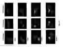 Fig. 10 - Radioactive-emission-measurement optimization to specific body structures