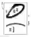 Fig. 37 - Radioactive-emission-measurement optimization to specific body structures