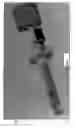 Fig. 40 - Radioactive-emission-measurement optimization to specific body structures