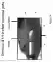 Fig. 45 - Radioactive-emission-measurement optimization to specific body structures