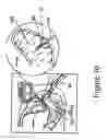 Fig. 47 - Radioactive-emission-measurement optimization to specific body structures