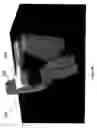 Fig. 67 - Radioactive-emission-measurement optimization to specific body structures