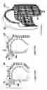 Fig. 84 - Radioactive-emission-measurement optimization to specific body structures