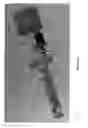 Fig. 91 - Radioactive-emission-measurement optimization to specific body structures