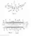 Fig. 03 - Multi-functional medical catheter and methods of use