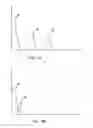 Fig. 07 - Multi-functional medical catheter and methods of use
