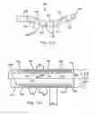 Fig. 11 - Multi-functional medical catheter and methods of use