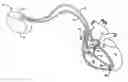 Fig. 01 - Cardiac therapy system including a triboelectric sensor