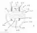 Fig. 01 - Neck brace