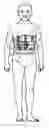 Fig. 01 - Lumbar selective stabilization support/brace