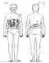Fig. 02 - Lumbar selective stabilization support/brace