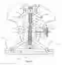 Fig. 03 - Dynamic, adjustable orthopedic device
