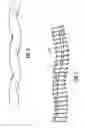 Fig. 09 - Device for placement externally of a body fluid flow conduit