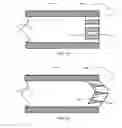 Fig. 04 - Glaucoma Treatment Devices and Methods
