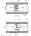 Fig. 05 - Glaucoma Treatment Devices and Methods
