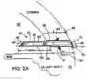 Fig. 08 - Glaucoma Treatment Devices and Methods