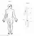 Fig. 02 - Implantable perfusion sensor