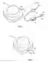 Fig. 02 - Fluid delivery apparatus