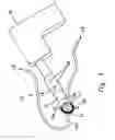 Fig. 04 - Apparatus and method for removing pigments from a pigmented section of skin