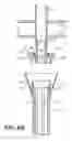 Fig. 07 - Catheter assembly and method for internally anchoring a catheter in a patient