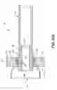 Fig. 09 - Catheter assembly and method for internally anchoring a catheter in a patient