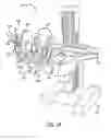 Fig. 03 - Robotic surgical systems with fluid flow control for irrigation, aspiration, and blowing