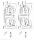 Fig. 31 - Robotic surgical systems with fluid flow control for irrigation, aspiration, and blowing