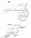 Fig. 02 - Foam electrode and method of use thereof during tissue resection