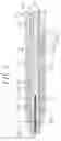 Fig. 03 - System and method for selectively energizing catheter electrodes