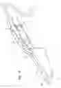 Fig. 08 - Liquid delivery apparatus for tissue ablation