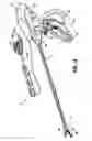 Fig. 02 - Bipolar concentric electrode assembly for soft tissue fusion