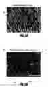 Fig. 04 - Method of fusing biomaterials with radiofrequency energy