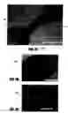 Fig. 05 - Method of fusing biomaterials with radiofrequency energy