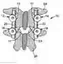 Fig. 01 - Instrument for pedicle screw adhesive materials