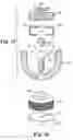 Fig. 08 - Instrument for pedicle screw adhesive materials
