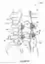 Fig. 04 - Therapeutic constructions, spinal plates, cervical plates, hooks and screws