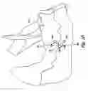 Fig. 10 - Bone fixation device and method